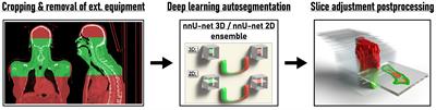 Deep learning for automatic head and neck lymph node level delineation provides expert-level accuracy